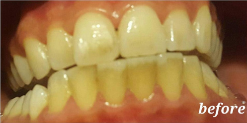 Untitled-design-4000