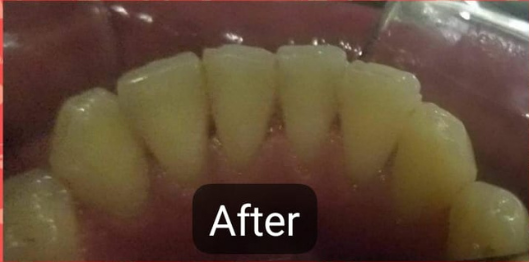 Untitled-design-9after